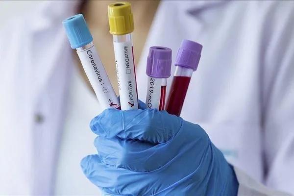 Sot 241 raste të reja me korona virus, shërohen 51 pacientë